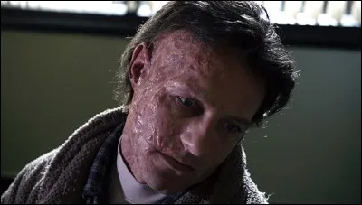 Qu'est-il arrivé à Peter ?