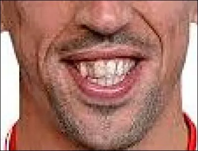 Lui, c'est un sportif français.