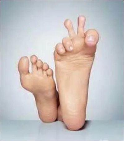 Qui a dit : A chaque pied son soulier ?