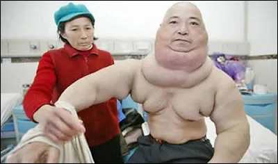 Quelle est la branche de la biologie qui étudie les malformations et les anomalies des êtres vivants ?