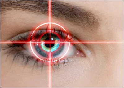 Qu'est-ce que le lasik ?
