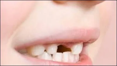 Comment sont appelées ces dents récoltées par la petite souris ?