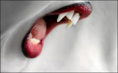 À quoi correspond l'endodontie chirurgicale ?