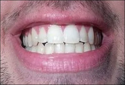 Lequel de ces deux accessoires utilises-tu pour te brosser les dents ?