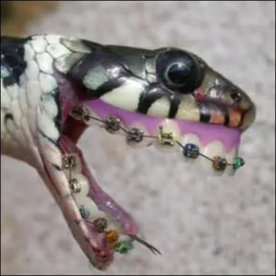 Peur du dentiste ? Ce n'est pas grave, vous êtes seulement...