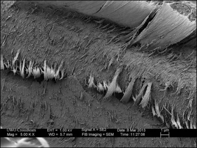 Quel est cet élément au microscope ?