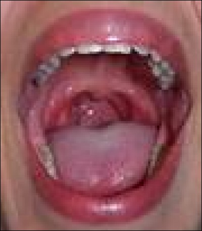 Combien de dents renferme la bouche d'un humain adulte ?