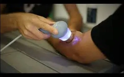 Quel bénéfice ne peut pas vous apporter une séance d'ultra-sons ?