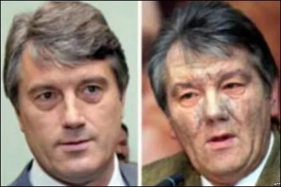 On se rappelle du visage de Viktor Iouchtchenko, leader ukrainien de la "Révolution Orange", qui avait changé si brutalement : que lui était-il arrivé ?