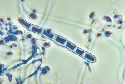Et pour finir, trouvez la bonne orthographe du nom de ce champignon.