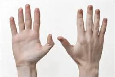 Comment appelle-t-on la face opposée à la face dorsale de la main ?