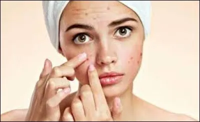 __ acné très sévère, à mon avis.