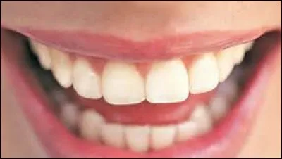 Laquelle de ces dents humaines ne comporte qu'une seule racine ?