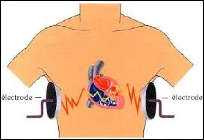 Se prendre une poignée de...