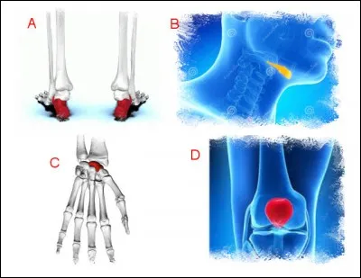 La partie du squelette qui contient le scapho&iuml;de se trouve en :