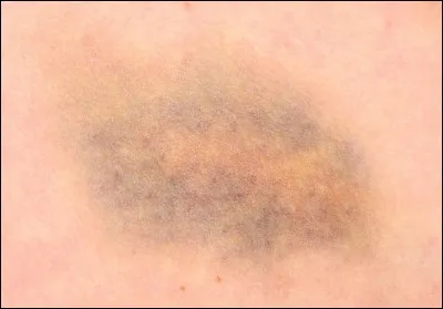 Quel est l'autre nom du coup appelé "bleu" ?