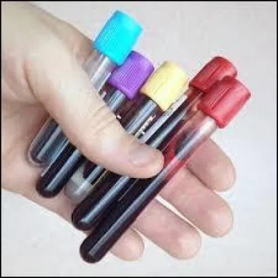 Lors de votre dernière prise de sang, les gamma-GT étaient trop élevés. Que devez-vous faire ?