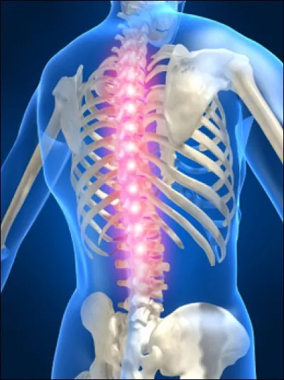 Qu'appelle-t-on spondylarthrite ?