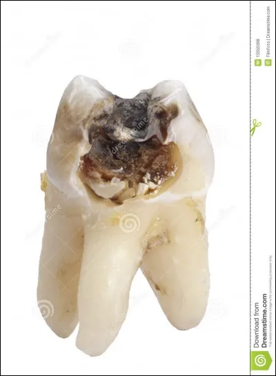 Tiens bah justement, puisque l'on parle de dent !