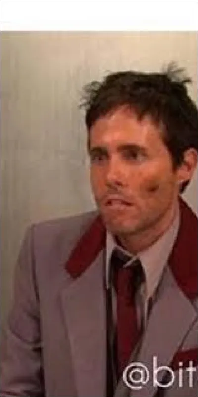 Que porte Lewbert sur sa joue gauche ?