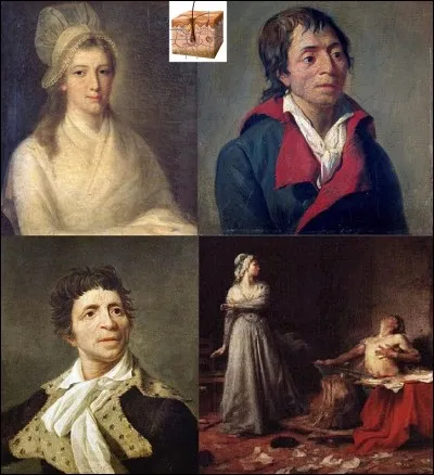 Allons « rue de l'École-de-Médecine » !
Nous sommes le 13 juillet 1793, Jean-Paul Marat décide de prendre un de ses nombreux bains journaliers. Charlotte Corday demande à le rencontrer sous le prétexte de dénoncer un complot. Après plusieurs tentatives, elle le rencontre. A ce moment, elle l'assassine dans son bain !
Pour quelle raison, Marat, prenait-il de nombreux bains ?