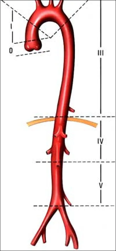 Nous va droit au cur.
