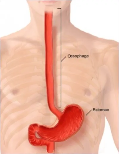 Avez-vous souffert de "pyrosis", cette pathologie qui affecte l'oesophage ? Comment se manifeste-t-elle ?