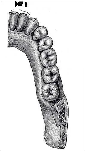 Quel nom portent ces dents ?