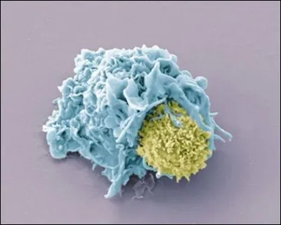 Que produisent les lymphocytes B pour combattre un agent pathogène ?