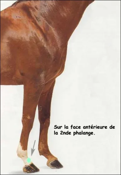 Quelle tare dure est sur cet antérieur ?