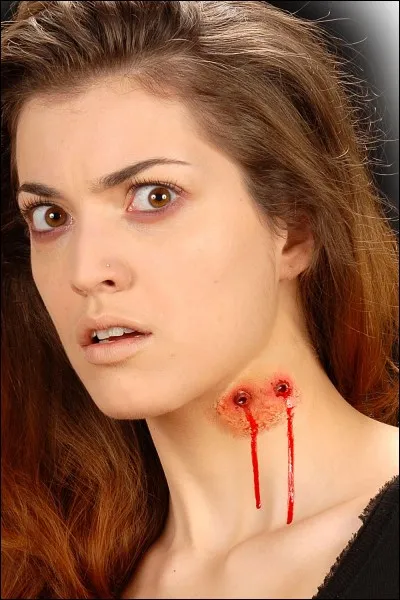 Qui a fait la morsure de 1987 ?