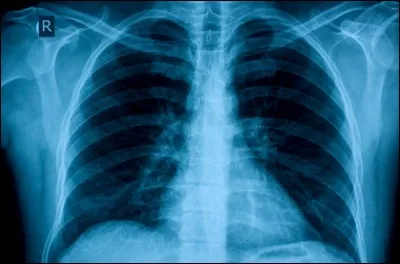 Quand fut effectuée la première radiographie ?