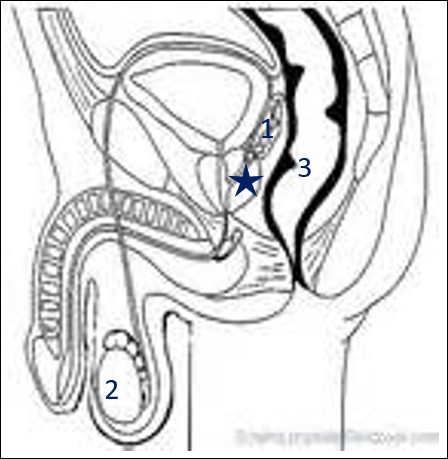Place désormais au pelvis masculin et à son schéma vu de côté.Quelle glande du système reproducteur masculin est représentée par un étoile bleue ?