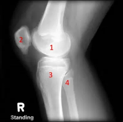 On continue ce quiz avec le membre inférieur.
Quelle articulation est présente sur cette radiographie ?