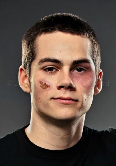 Pourquoi Stiles refuse-t-il d'être un loup-garou quand Peter lui en donne l'occasion ?