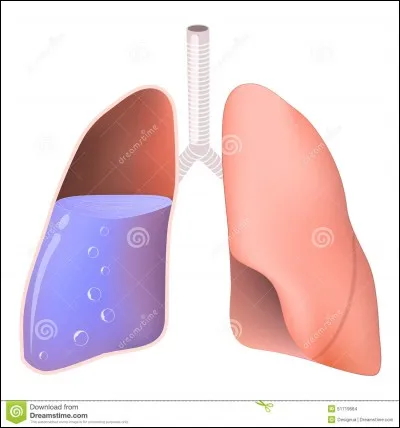 Si on appuie sur le poumon dans l'eau, que se passe-t-il ?