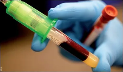 Dans le cas d'un portage chronique inactif ...