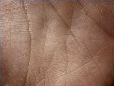 Qu'est une muqueuse ?