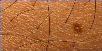 Chaque follicule de poil est relié a un muscle.