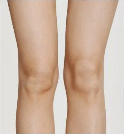 De quelle partie du corps humain s'agit-il ?