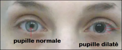 Dis-moi si tes pupilles sont dilat&eacute;es actuellement.