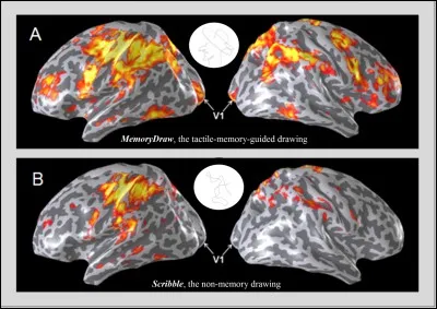 Comment est appelée la capacité du cerveau à établir des connexions entre les aires cérébrales ?