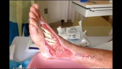 D'après vous, quelle est l'origine de cette effrayante blessure ?