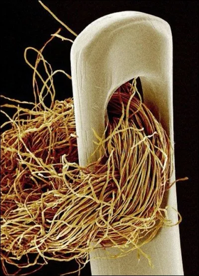 Sur cette photo, on peut voir du fil et une aiguille au microscope.