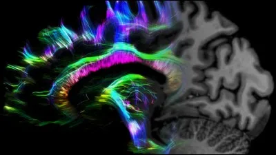 Vrai ou faux ?
Le cerveau ne peut pas agir sur les glandes.