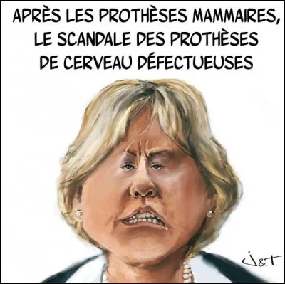 Peut-on 'naître' sans cerveau (j'ai bien dit 'naître' pas 'vivre') ?