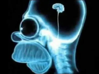 A quel personnage de série d'animation appartient ce cerveau ?