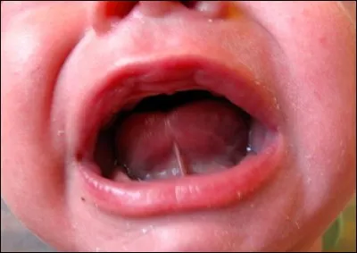 Parti du mors, on le ronge quand on contient sa colère.