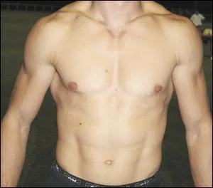 A quel joueur d'Ad appartient ce torse ?