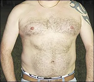 A quel joueur d'Oursbelille-Bordres appartient ce torse ?